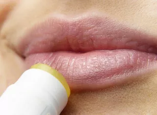 El herpes labial se suele contagiar por el contacto bucal. Imagen ilustrativa Pixabay