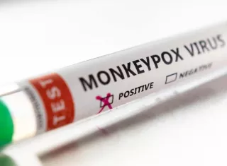 Al paciente se le tomaron muestras que fueron enviadas al Gorgas.