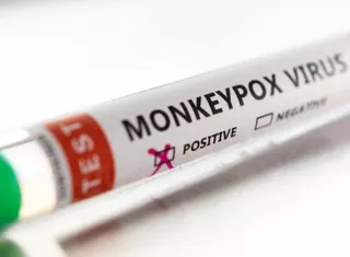 Al paciente se le tomaron muestras que fueron enviadas al Gorgas.