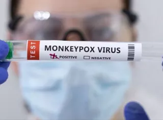 En el Instituto Conmemorativo Gorgas se analizan y confirman los casos de viruela símica.