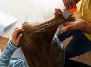 Los piojos son cada vez más resistentes a los compuestos químicos. Foto ilustrativa / Freepik.