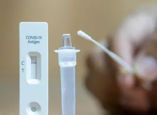 La semana pasada se aplicaron 2, 289 pruebas diagnósticas.