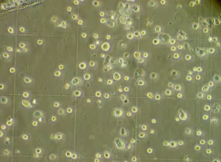 Aspecto de las células madre. EFE / Archivo