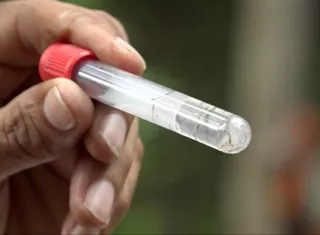 En la semana se confirmó 1 nueva defunción por dengue.