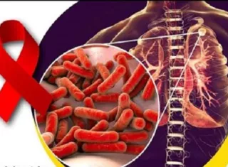 Instan uso del preservativo.