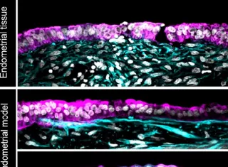 Logran implantar con éxito un embrión en un endometrio artificial
