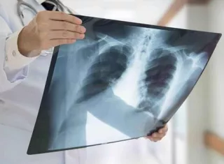 Reiteró su llamado a la población a completar los tratamientos de manera responsable. Foto: Cortesía 