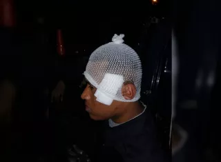 La bala le abrió una brecha en la sien.  /  Foto: chiriquinoticiaa