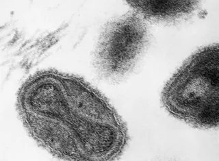 De todas las enfermedades traídas por los colonos, la viruela —causada por el virus Variola major— fue la más impactante. Foto: CDC/ Dr. Fred Murphy; Sylvia Whitfield