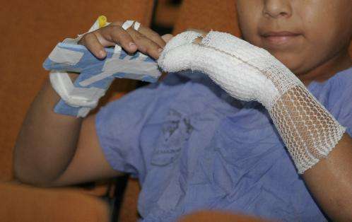 Niños afectados en dedos y manos por manipular bombitas y fuegos artificiales.