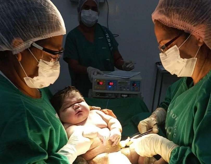 El bebé sigue bajo observación neonatal.