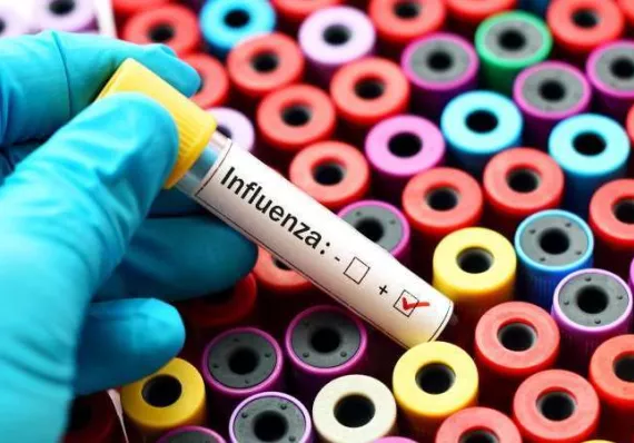 ¡Alerta! Influenza suma 55 muertos y síndrome gripal supera los 22 mil casos