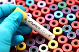 ¡Alerta! Influenza suma 55 muertos y síndrome gripal supera los 22 mil casos