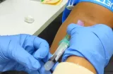 Cáncer de próstata lidera incidencia en hombres