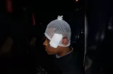 Balean policía en el rostro en Veracruz