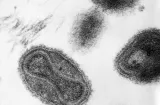 Científicos estudian huellas de epidemias en comunidades indígenas de América