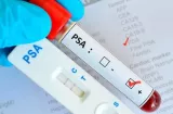 ¡Alerta con el  PSA! Minsa aclara el miedo que paraliza a miles de hombres 