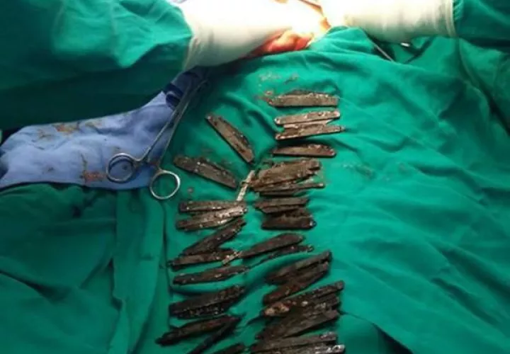 Foto cortesía del Hospital Amritsar corporativa, Amritsar, en la India).