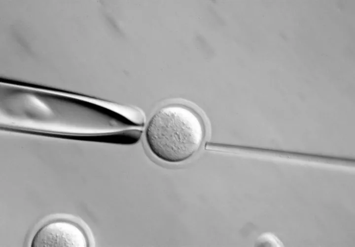 Una imagen microscópica de una célula.  /  Foto: EFE Archivo