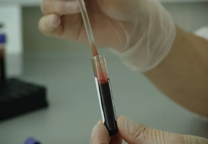 Las últimas pruebas de laboratorio muestran que el virus ya no está presente en la sangre del paciente, aunque los médicos desean mantener la calma y esperar unos meses para declararlo completamente curado de la enfermedad. /  Foto: Ilustrativa - Pixabay