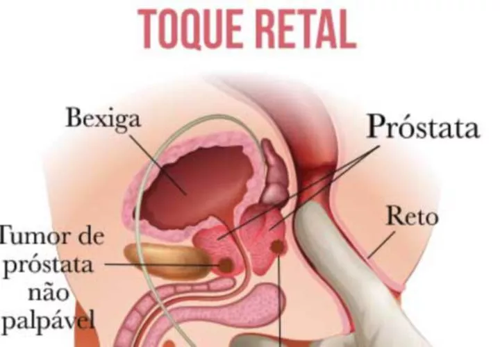 Para todos los ciudadanos porque no estamos pendientes de nuestra salud. En el 2015 se atendieron en el Oncológico más de 3,200 casos de diferentes tipos de cáncer. Además, autoridades de Salud en el país han advertido que las mujeres y los hombres no se están haciendo sus exámenes de mamas y próstata.