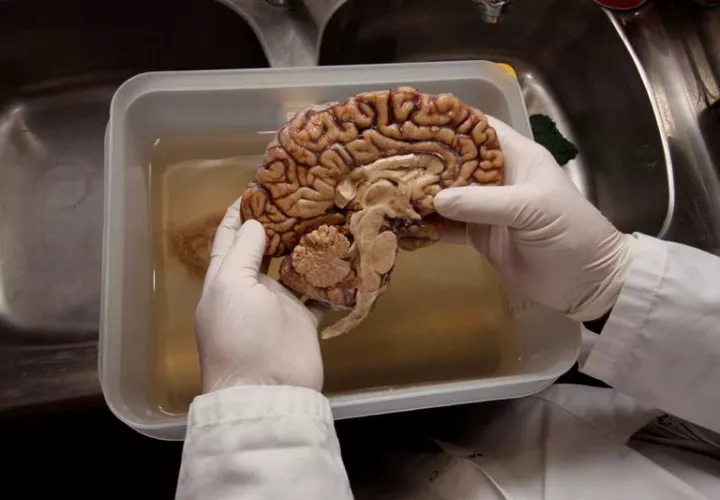 Los avances en el estudio del origen neuroquímico del placer son una pieza clave para la neurociencia en general.  /  Foto: EFE