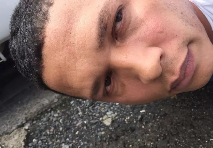 Se tiñó el cabello y se hizo una cirugía plástica.