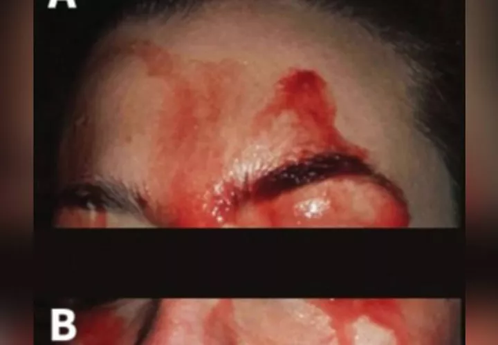 Imagen http://www.cmaj.ca