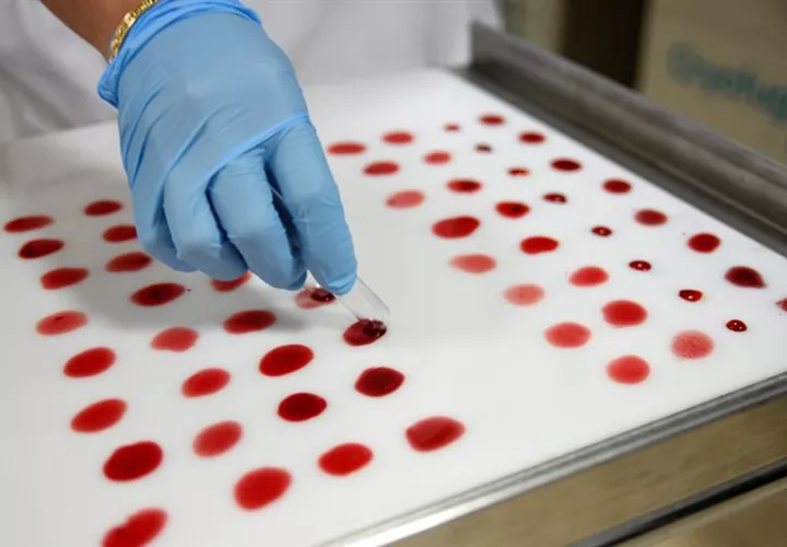 Investigadores nipones han desarrollado una prueba sanguínea para detectar cáncer e identificar el tipo de tumor con una precisión de casi el 90 %. EFE/Archivo