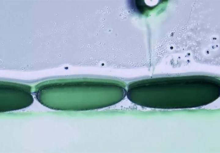 Un grupo de científicos desarrolló un dispositivo bio-óptico que detecta la formación de coágulos sanguíneos y ayuda a prevenir derrames cerebrales y ataques al corazón. EFE/Archivo