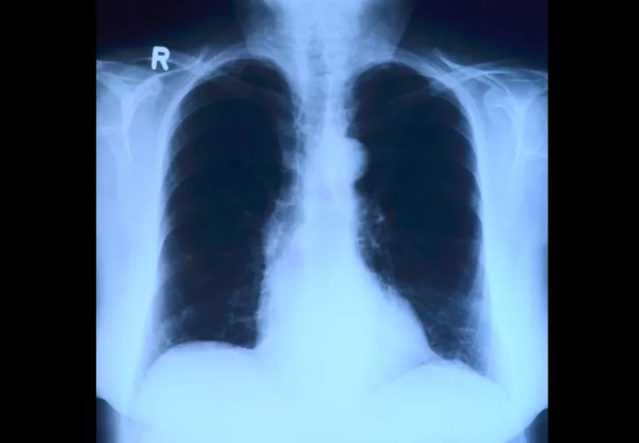 Foto: Ilustrativa - Pixabay