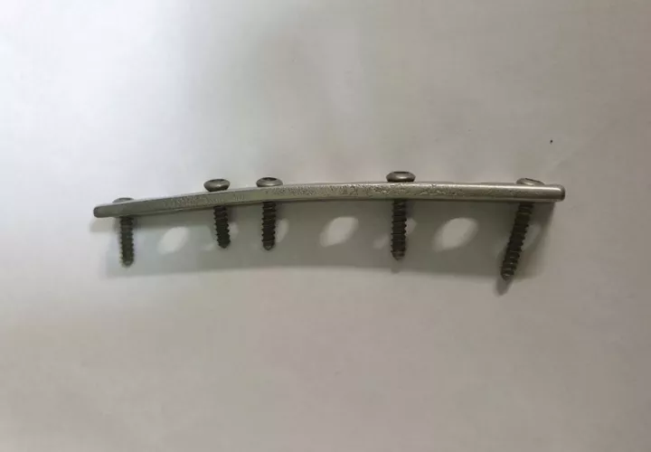 Placa ortopédica ubicada dentro de un cocodrilo en Coowonga, Australia, después de que fuera encontrada en el estómago de un cocodrilo. (John Lever vía AP)