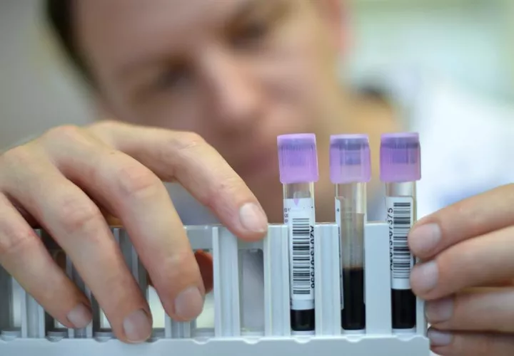 El método PERSEVERE, mide los niveles de cinco biomarcadores y permite que los médicos detecten y estratifiquen la septicemia en sus primeros momentos cuando el cuerpo está a punto de desencadenar una infección bacterial generalizada. EFE