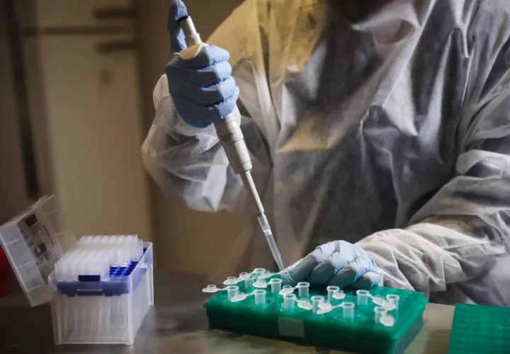 Los casos globales de COVID-19 se elevaron hoy a 40,4 millones, casi 300.000 más que en la jornada anterior. EFE