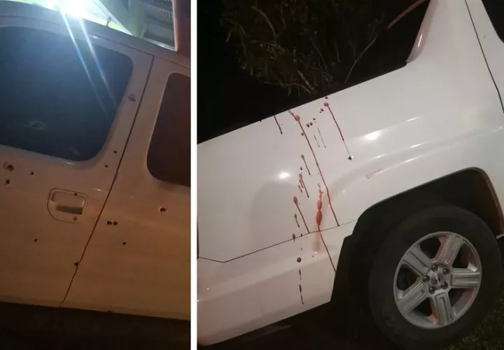 La víctima se mantiene en condición delicada.