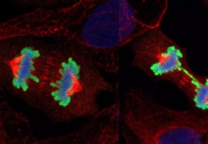 Comparación entre células sanas en fase de duplicación (i) con células dañadas (d). EFE