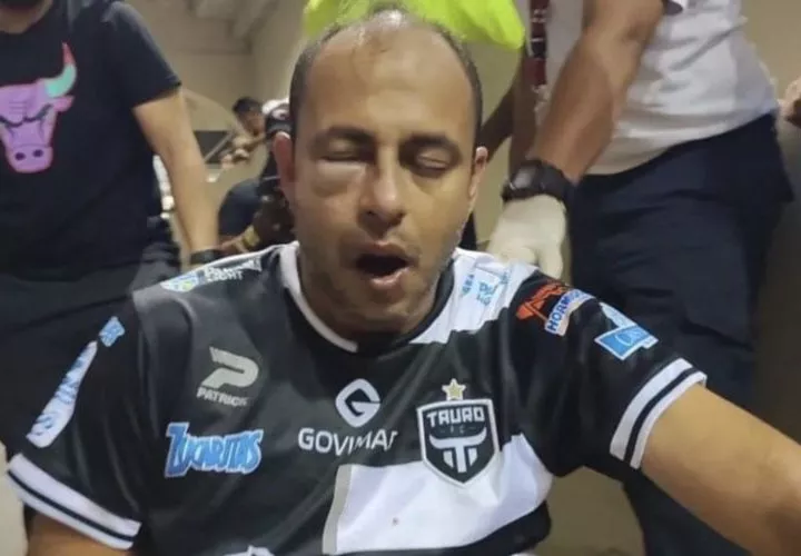 El señor José Ducasa resultó gravemente herido. Foto: Tauro FC