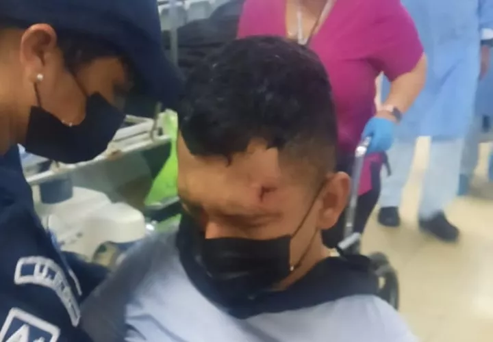 La unidad policial terminó con un brecha en la frente.