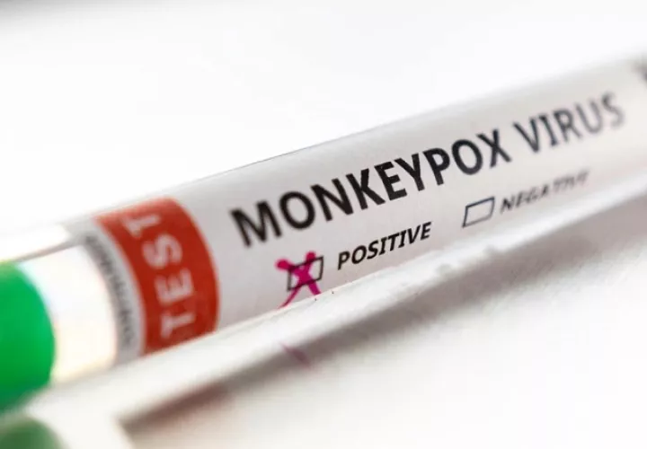 Al paciente se le tomaron muestras que fueron enviadas al Gorgas.