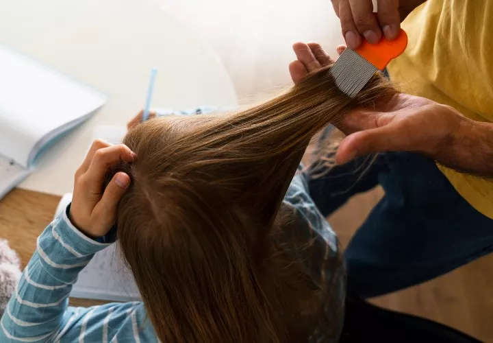 Los piojos son cada vez más resistentes a los compuestos químicos. Foto ilustrativa / Freepik.