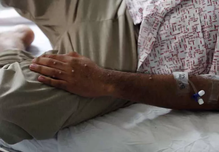 Del total de casos, 158 corresponden a personas del sexo masculino, y solo dos al femenino.