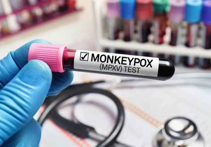 Las pruebas fueron enviadas al Instituto Conmemorativo Gorgas, con resultado positivo.