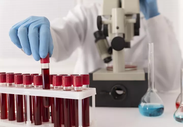 En el año 2020 más de 500 personas fueron diagnosticadas con algún tipo de cáncer de sangre en Panamá. Foto ilustrativa / Freepik.