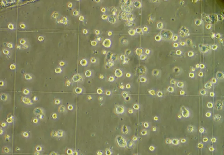 Aspecto de las células madre. EFE / Archivo