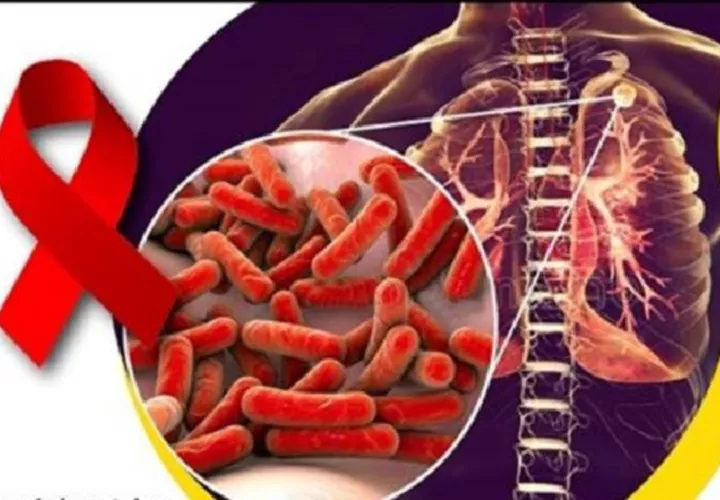 Instan uso del preservativo.