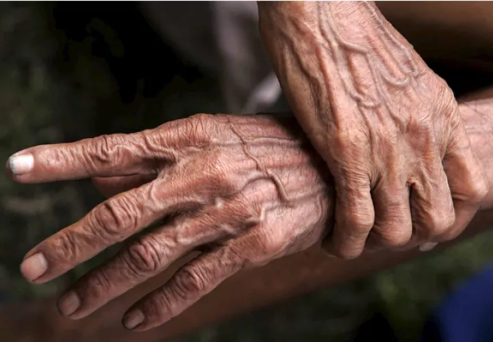 Las manos de una persona mayor. Foto: EFE