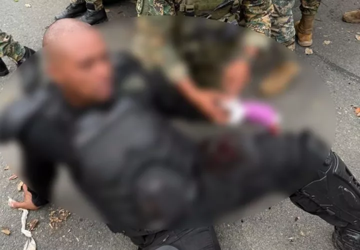 Unidad de Senafront herido durante protesta.