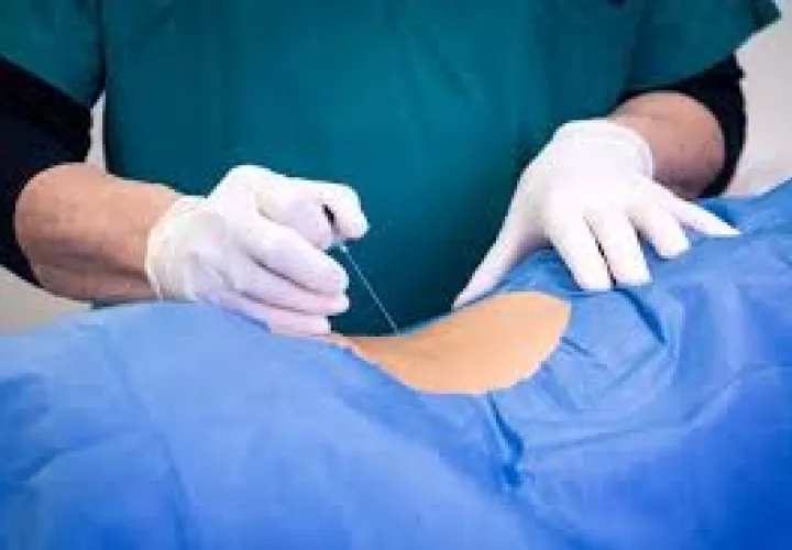 Operación en zona lumbar.   (Foto: Ilustrativa)