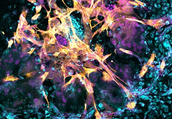 Usaron información del tejido donado para identificar los componentes clave que dan estructura al revestimiento uterino. Foto: EFE