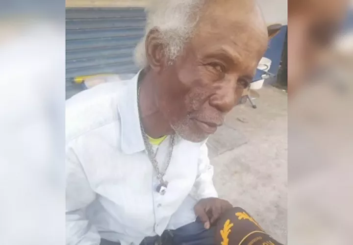 Adulto mayor Rogelio Hudson esta delicado tras ser atacado a pedradas.  /  Foto: Diómedes Sánchez